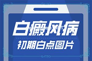 ׃L(fng)ʲôӵıF(xin)-ϳF(xin)װ