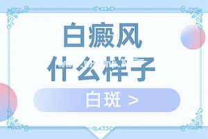 ׵PܸΆ[L(fng)ô]ꎵװô