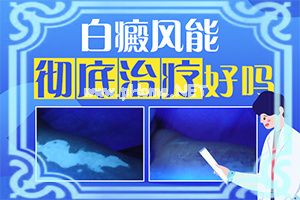 L(fng)ͨ^(gu)ʲôȾ-ͯ沿L(zhng)װ