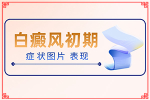 oָװô,cdL(fng)ĳڈD
