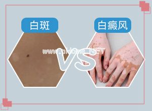 [(jin)]Ӵ_ǲǰװ-׎p呪(yng)ԓעʲô