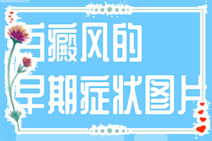 С_аɫKʲôԭôί