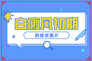 ƤwаɫСKô