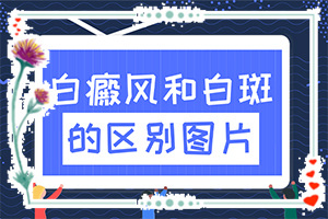  װЕrWô