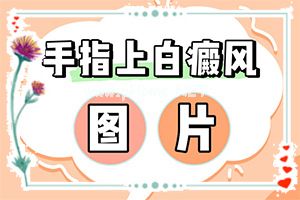 ĘL(zhng)˰װʲô-L(zhng)һ(g)(g)װ