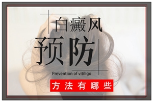 「蟄」時節頸背部白癜風怎么護理