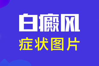 辨別皮膚白斑的早期癥狀