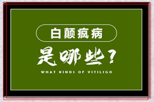 ˵ⷿע:סh(hun)(du)ϰL(fng)l(f)Ӱ