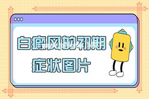 ֱL(zhng)Сװ-L(fng)ʲô(li)(qing)