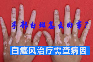 ίL(fng)Ҋ`^(q)Щ