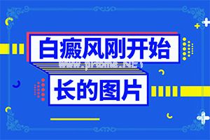 L(fng)ͨ^(gu)ʲôȾ-ͯ沿L(zhng)װ