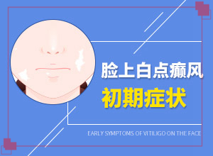 ͯװdίL(zhng)һKô