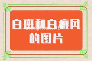 (ί)cdLz[õķ]