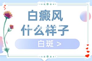dL(fng)ίװЩ÷-ίô