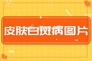沿װ߹Ά[cdLW]